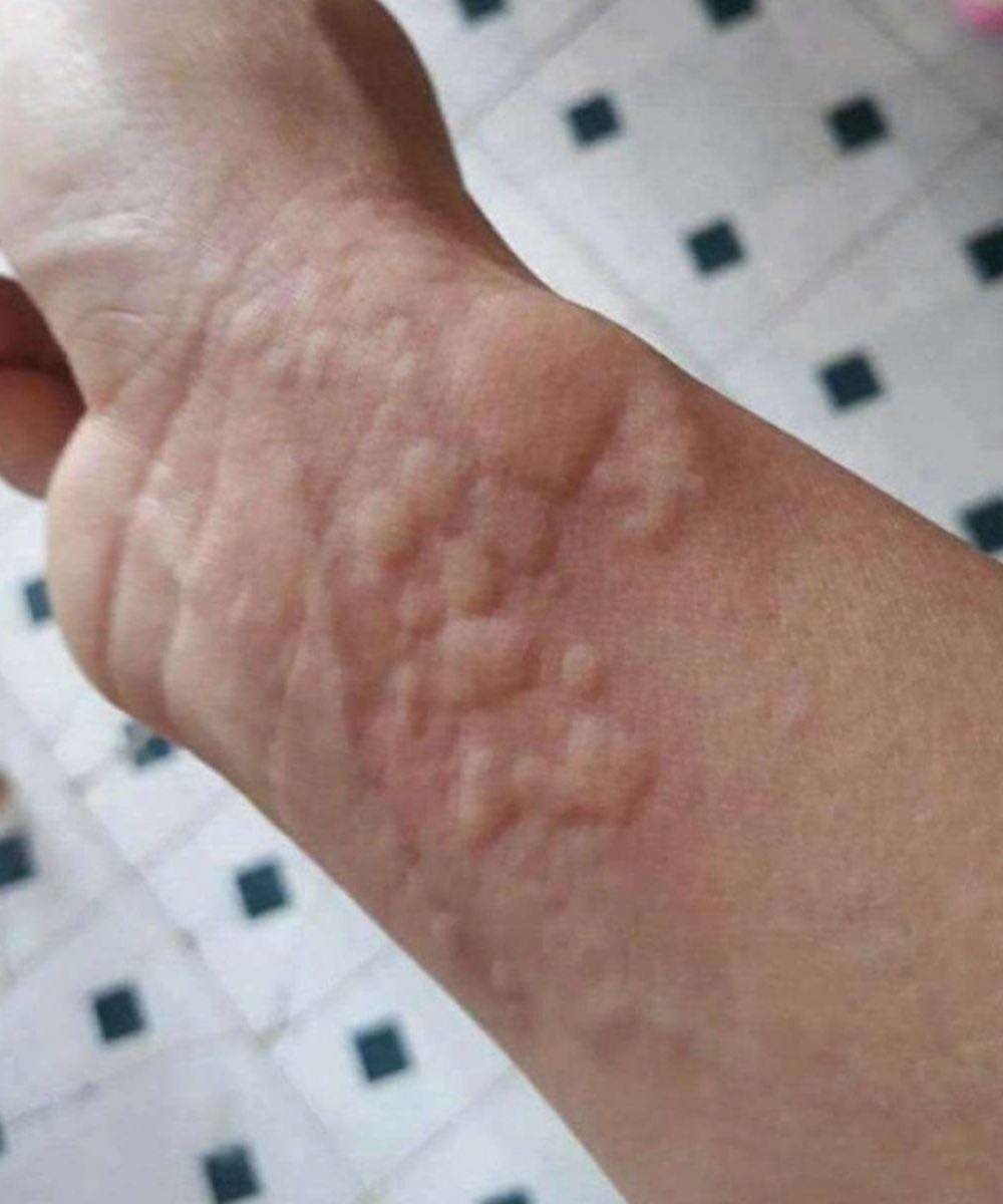These are the consequences of sleeping with…
