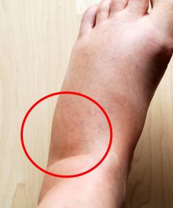 These are the consequences of sleeping with…