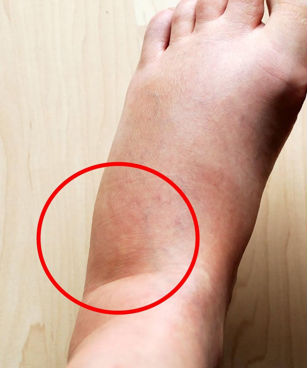 These are the consequences of sleeping with…